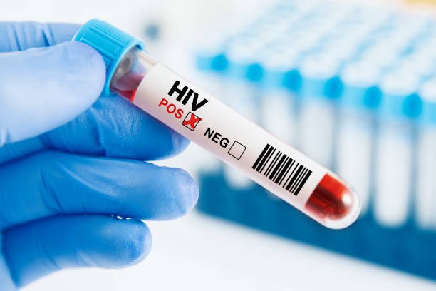  Which Country Has The Highest Hiv Aids Rate In Africa